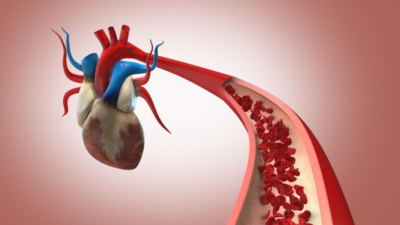  心梗风险深度拆解：心血管内科十二年急诊实录与六大高危行为量化分析 健康养生